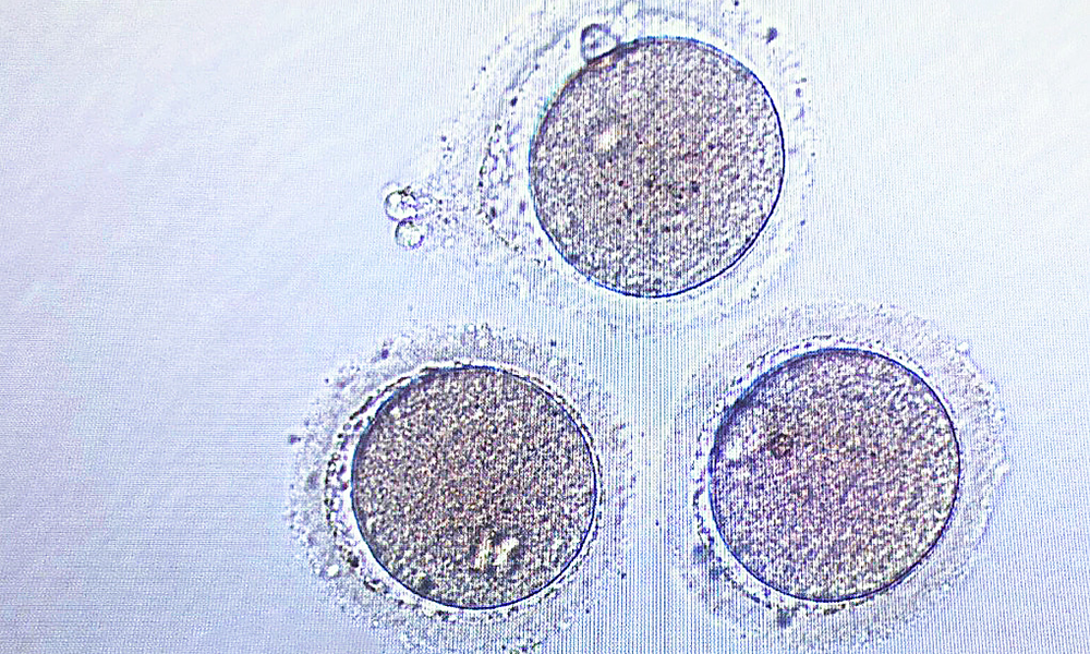 Human eggs under the microscope